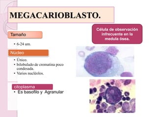 MEGACARIOBLASTO.Célula de observación infrecuente en la medula ósea.