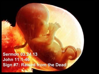 Sermon 03.24.13
John 11:1-46
Sign #7: Raised from the Dead
 
