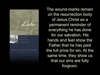 The wound-marks remain
on the resurrection body
of Jesus Christ as a
permanent reminder of
everything he has done
for our salvation. His
hands and feet show the
Father that he has paid
the full price for sin. At the
same time, they show us
that our sins are fully
forgiven.
 