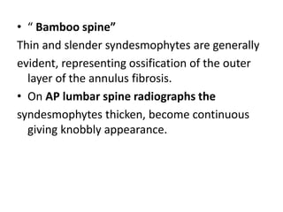 • “ Bamboo spine”
Thin and slender syndesmophytes are generally
evident, representing ossification of the outer
layer of the annulus fibrosis.
• On AP lumbar spine radiographs the
syndesmophytes thicken, become continuous
giving knobbly appearance.
 