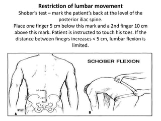 Restriction of lumbar movement
Shober’s test – mark the patient’s back at the level of the
posterior iliac spine.
Place one finger 5 cm below this mark and a 2nd finger 10 cm
above this mark. Patient is instructed to touch his toes. If the
distance between finegrs increases < 5 cm, lumbar flexion is
limited.
 