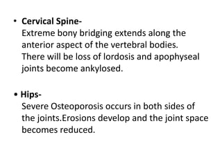 • Cervical Spine-
Extreme bony bridging extends along the
anterior aspect of the vertebral bodies.
There will be loss of lordosis and apophyseal
joints become ankylosed.
• Hips-
Severe Osteoporosis occurs in both sides of
the joints.Erosions develop and the joint space
becomes reduced.
 