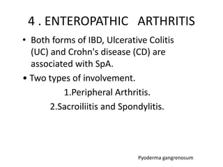 4 . ENTEROPATHIC ARTHRITIS
• Both forms of IBD, Ulcerative Colitis
(UC) and Crohn's disease (CD) are
associated with SpA.
• Two types of involvement.
1.Peripheral Arthritis.
2.Sacroiliitis and Spondylitis.
Pyoderma gangrenosum
 