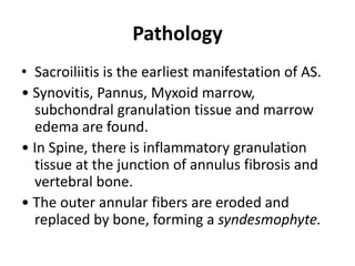 Pathology
• Sacroiliitis is the earliest manifestation of AS.
• Synovitis, Pannus, Myxoid marrow,
subchondral granulation tissue and marrow
edema are found.
• In Spine, there is inflammatory granulation
tissue at the junction of annulus fibrosis and
vertebral bone.
• The outer annular fibers are eroded and
replaced by bone, forming a syndesmophyte.
 