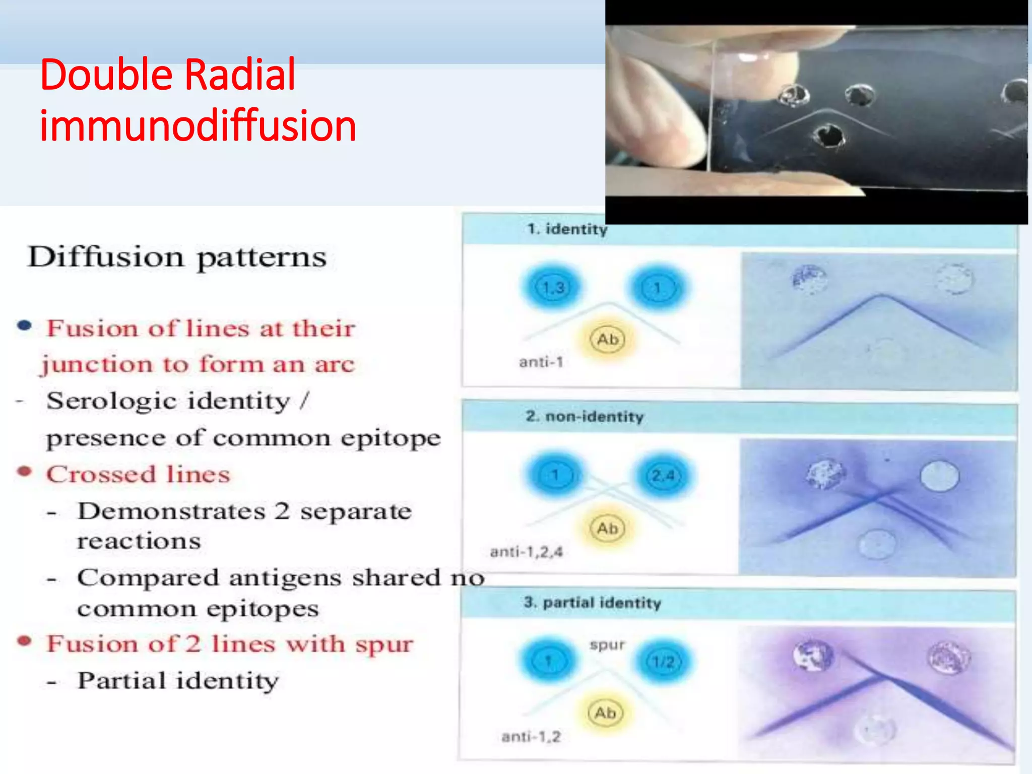 Serological Diagnosis of Infectious Diseases | PPTX