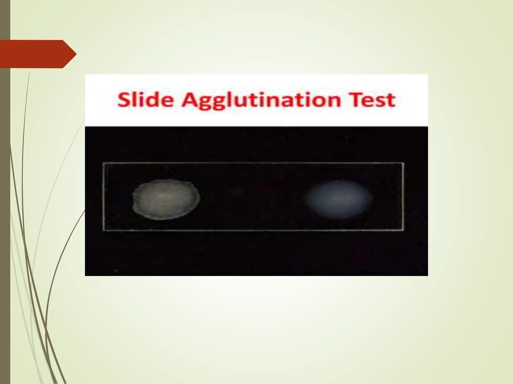 serological techniques for detection of plant virus.pptx