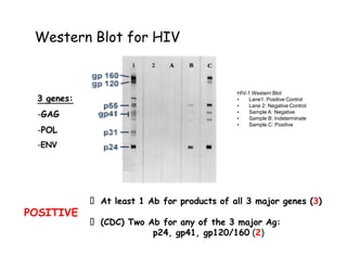 Western Blot for HIV
HIV-1 Western Blot
• Lane1: Positive Control
• Lane 2: Negative Control
• Sample A: Negative
• Sample B: Indeterminate
• Sample C: Positive
At least 1 Ab for products of all 3 major genes (3)
(CDC) Two Ab for any of the 3 major Ag:
p24, gp41, gp120/160 (2)
3 genes:
-GAG
-POL
-ENV
POSITIVE
 