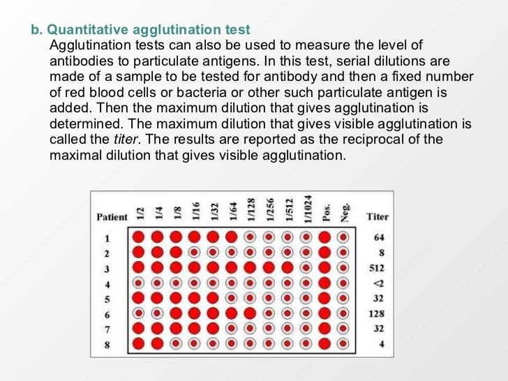 Importance Of Serial Dilution In Serology Tests