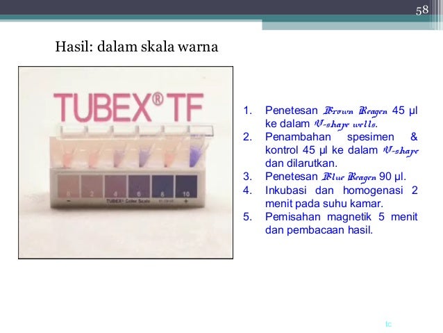 Titer Widal Di Mikroskop : Tes ANA pada Penyakit Lupus dan Autoimun