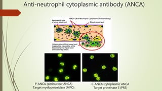 Serology in Renal Diseases.pptx