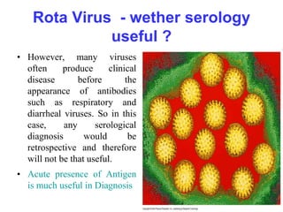 Rota Virus - wether serology
useful ?
• However, many viruses
often produce clinical
disease before the
appearance of antibodies
such as respiratory and
diarrheal viruses. So in this
case, any serological
diagnosis would be
retrospective and therefore
will not be that useful.
• Acute presence of Antigen
is much useful in Diagnosis
 