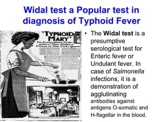 Widal test a Popular test in
diagnosis of Typhoid Fever
• The Widal test is a
presumptive
serological test for
Enteric fever or
Undulant fever. In
case of Salmonella
infections, it is a
demonstration of
agglutinating
antibodies against
antigens O-somatic and
H-flagellar in the blood.
 