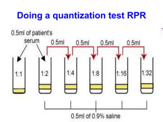 Doing a quantization test RPR
 