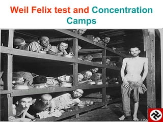 Weil Felix test and Concentration
Camps
 