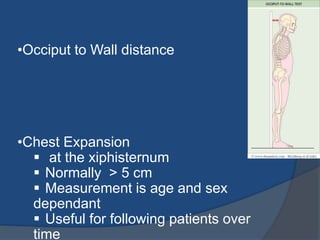 •Occiput to Wall distance
•Chest Expansion
 at the xiphisternum
 Normally > 5 cm
 Measurement is age and sex
dependant
 Useful for following patients over
time
 