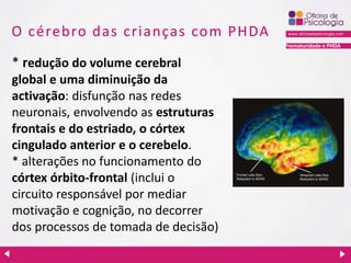 Prematuridade e PHDA
O cérebro das crianças com PHDA
* redução do volume cerebral
global e uma diminuição da
activação: disfunção nas redes
neuronais, envolvendo as estruturas
frontais e do estriado, o córtex
cingulado anterior e o cerebelo.
* alterações no funcionamento do
córtex órbito-frontal (inclui o
circuito responsável por mediar
motivação e cognição, no decorrer
dos processos de tomada de decisão)
 