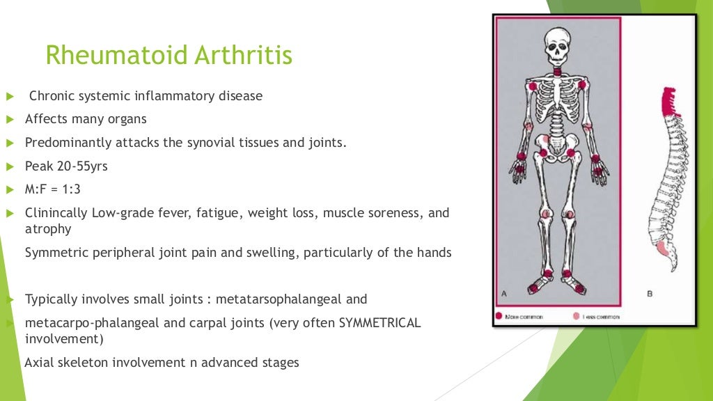 Seropositive arthritis Rheumatoid and others