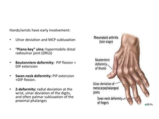 Hand Deviation Seropositive arthritis ppt | PPTX