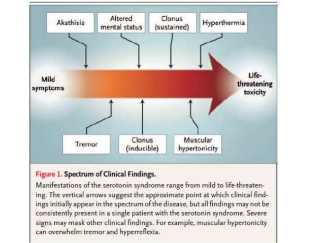 Ssri serotonin syndrome