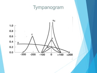 Tympanogram
2012
 