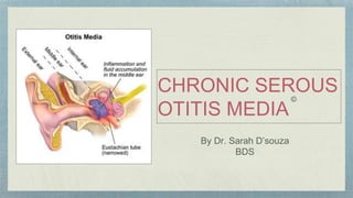 CHRONIC SEROUS
OTITIS MEDIA
By Dr. Sarah D’souza
BDS
©
 
