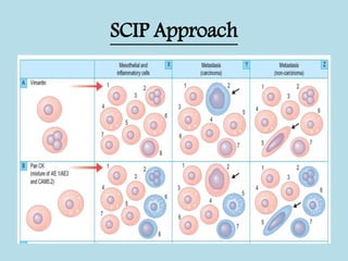 Serous pleural effusions and recent advances | PPTX