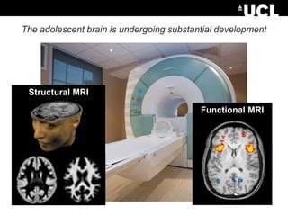 The adolescent brain is undergoing substantial development

Structural MRI
Functional MRI

 