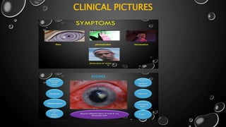 CLINICAL PICTURES
 