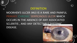 DEFINITION
MOORHEN'S ULCER (MU) IS A RARE AND PAINFUL
PRIMARY CHRONIC SERPIGINOUS ULCER WHICH
OCCURS IN THE ABSENCE OF ANY ASSOCIATED
SCLERITIS , AND ANY DETECTABLE SYSTEMIC
DISEASE.
 