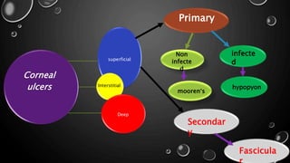 Corneal
ulcers
superficial
Interstitial
Deep
Primary
Secondar
y
infecte
d
Non
infecte
d
hypopyon
mooren’s
Fascicula
 
