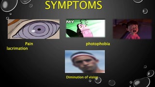 SYMPTOMS
Pain photophobia
lacrimation
Diminution of vision
 
