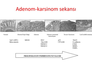 Adenom-karsinom sekansı
 