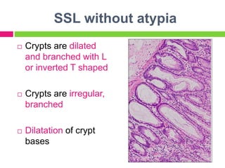 Serrated lesions of colon and rectum | PPTX
