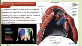 Pectodil Injection Ultrasound-Guided Pectoral Region Nerve Blocks for Postoperative ...