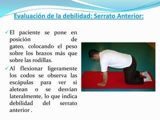 Evaluación de la debilidad: Serrato Anterior:
El paciente se pone en
posición de
gateo, colocando el peso
sobre los brazos más que
sobre las rodillas.
Al flexionar ligeramente
los codos se observa las
escápulas para ver si
aletean o se desvían
lateralmente, lo que indica
debilidad del serrato
anterior .
 