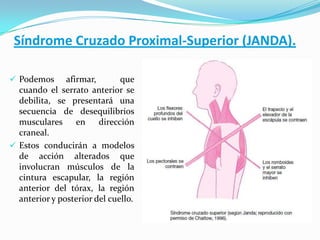 Síndrome Cruzado Proximal-Superior (JANDA).
 Podemos afirmar, que
cuando el serrato anterior se
debilita, se presentará una
secuencia de desequilibrios
musculares en dirección
craneal.
 Estos conducirán a modelos
de acción alterados que
involucran músculos de la
cintura escapular, la región
anterior del tórax, la región
anterior y posterior del cuello.
 