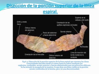Disección de la porción superior de la línea
espiral.
Fig 6.4; Disección de la porción superior de la línea espiral que muestra las claras
continuidades fasciales desde el cráneo hasta la cadera mediante los
esplenios, romboides, serrato anterior y fascias abdominales que envuelven los oblicuos.
Se ha retirado la escapula de la muestra, lo que deja una línea visible en la porción
serrato-romboidea de la lamina, pero no una discontinuidad.
 