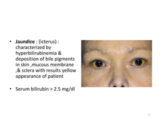 • Jaundice : (icterus) :
characterized by
hyperbilirubinemia &
deposition of bile pigments
in skin ,mucous membrane
,& sclera with results yellow
appearance of patient
• Serum bilirubin > 2.5 mg/dl
11
 