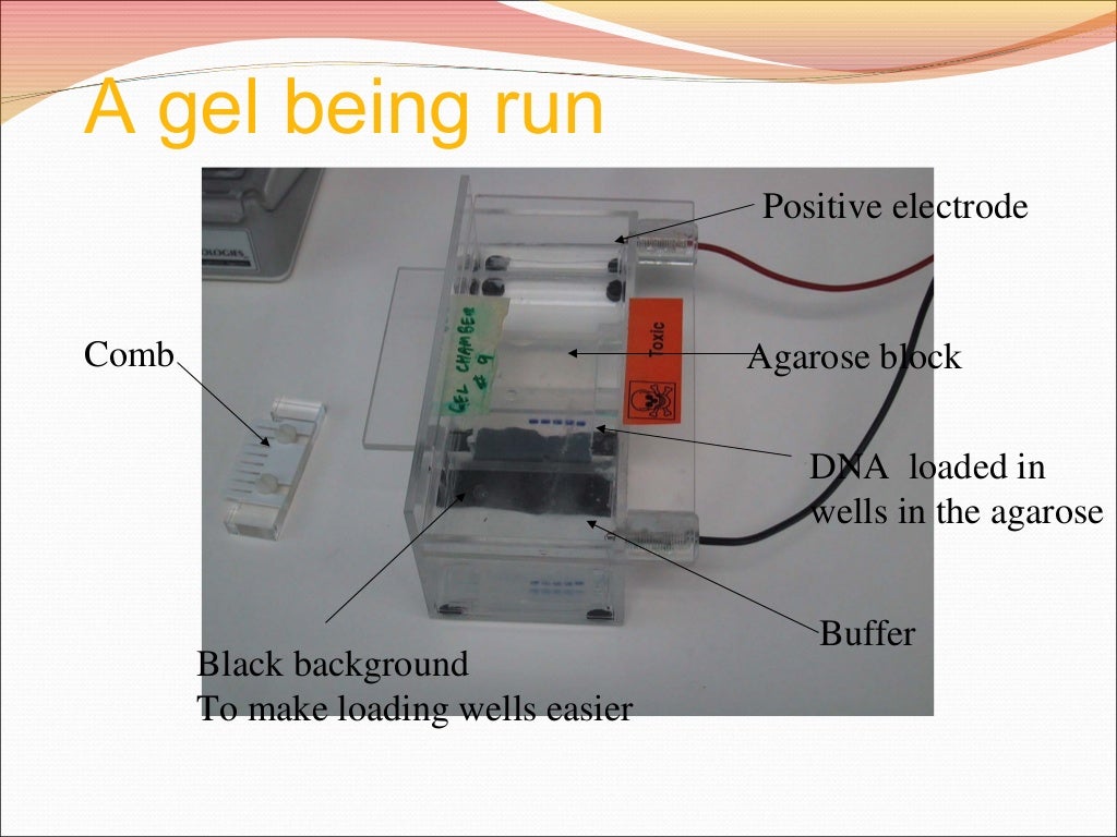 Serum protein electrophoresis & their clinical importance