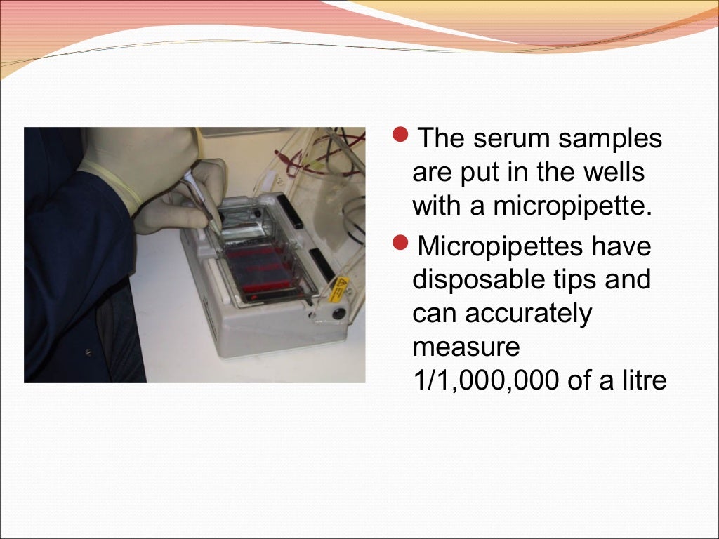 Serum protein electrophoresis & their clinical importance