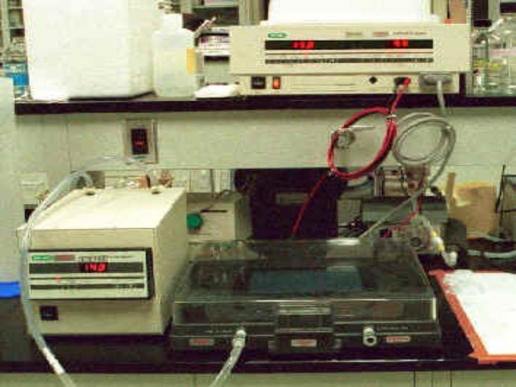 Serum protein electrophoresis & their clinical importance