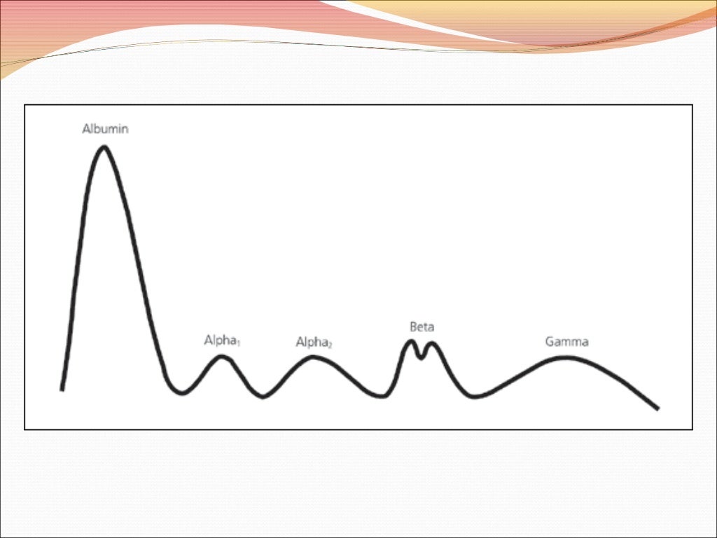 Serum protein electrophoresis & their clinical importance