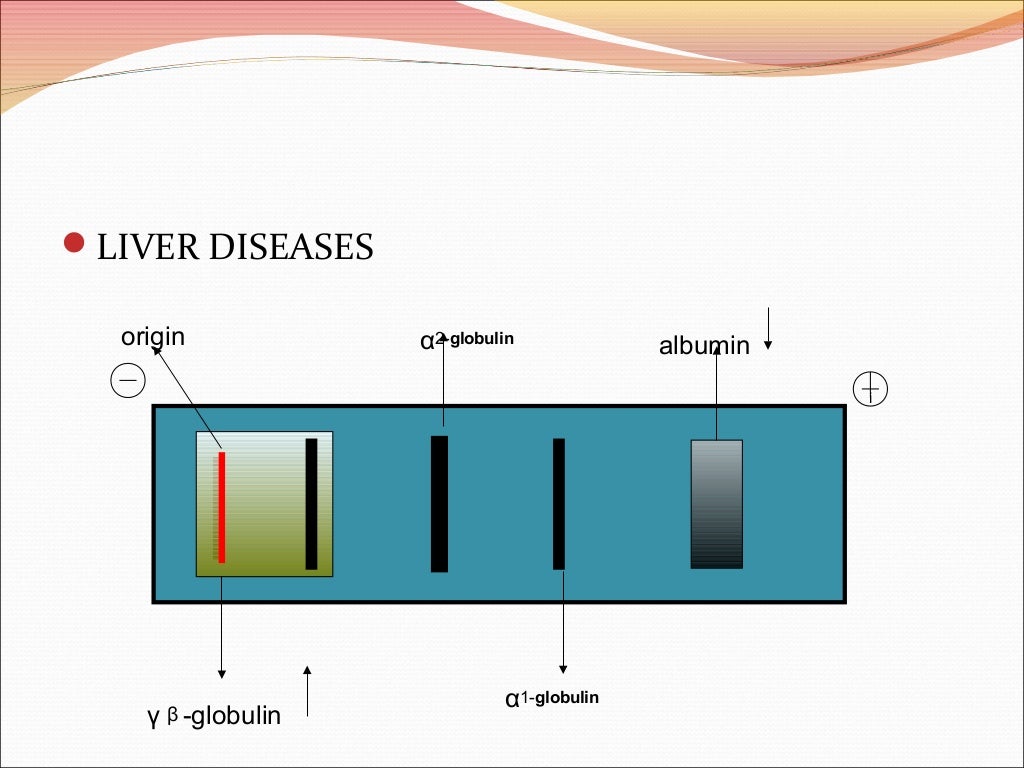 Serum protein electrophoresis & their clinical importance
