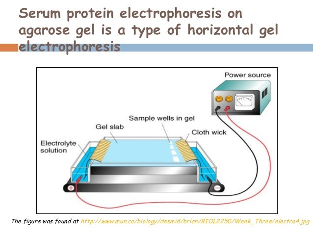 serum protein electrophpresis serum electophoresis