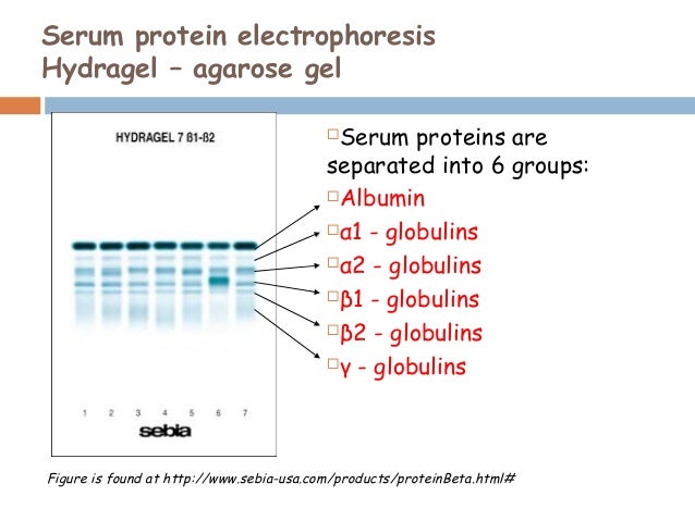 serum protein electrophpresis serum electophoresis