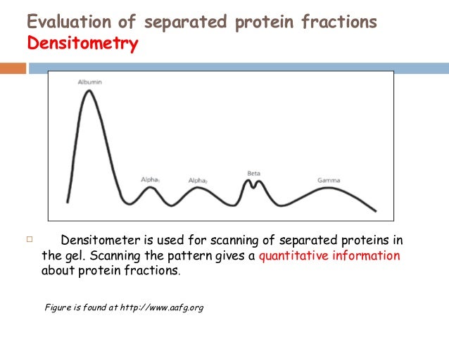 serum protein electrophoresis Serum protein electrophoresis (spe) separates proteins into multiple bands based on the size and charge of the protein each band on the spe gel represents one or more proteins with similar. serum protein electrophoresis Serum protein electrophoresis (spe) separates proteins into multiple bands based on the size and charge of the protein each band on the spe gel represents one or more proteins with similar.