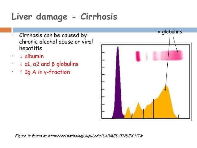 serum electrophoresis