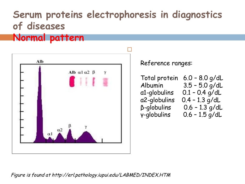 Serum protein electrophpresis