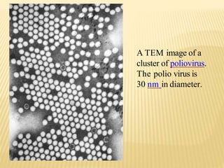 A TEM image of a
cluster of poliovirus.
The polio virus is
30 nm in diameter.
 