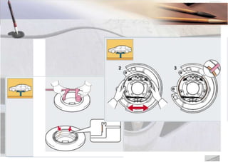 Prosedur Servis Berkala
Pemeriksaan rem tromol
5
6
 